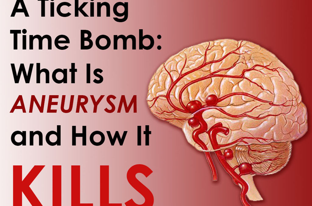 A Ticking Time Bomb: What Is Aneurysm and How It Kills