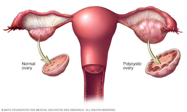 5 Reasons Why Women Should Take Ampalaya Plus (Besides Helping Lower Blood Sugar)